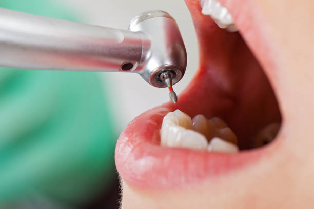 Best Pediatric Emergency Dentist in Macedonia, OH